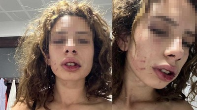 Kendisinden ayrılmak isteyen sevgilisini saatlerce dövdü