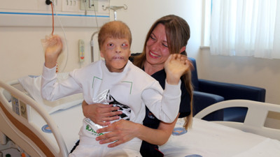 Gözleri kurtarılan Myhailo'ya, şimdi kulak kepçesi yapılacak