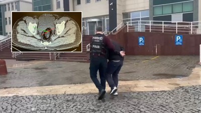 İranlı yolcunun makatından uyuşturucu çıktı