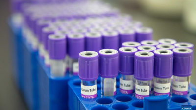 NHS: Kanseri tespit edebilen kan testini denemeye hazırız