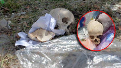 Adana'da çöpte bulunan kafatasının sırrı çözüldü