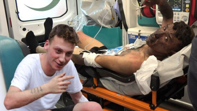 'Korku evi'nde testere tamiri sırasında çıkan yangında 3 kişi yaralandı