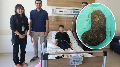9 yaşındaki çocuğun midesinden saç yumağı çıktı