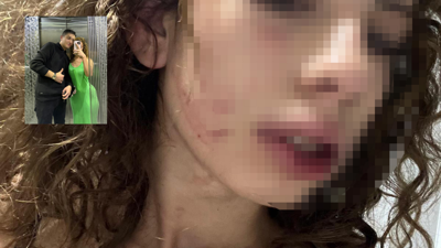 Ayrılmak isteyen sevgilisini saatlerce dövmüştü; istenen ceza belli oldu