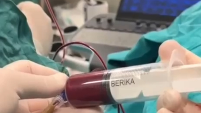 Anne karnındaki 8 aylık bebeğe kan nakli yapıldı