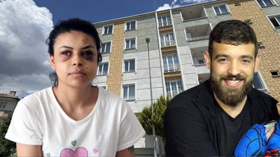 Düğünde tüfekle ateş açıldı, penceredeki Nazar gözlerinden yaralandı