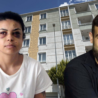 Düğünde tüfekle ateş açıldı, penceredeki Nazar gözlerinden yaralandı