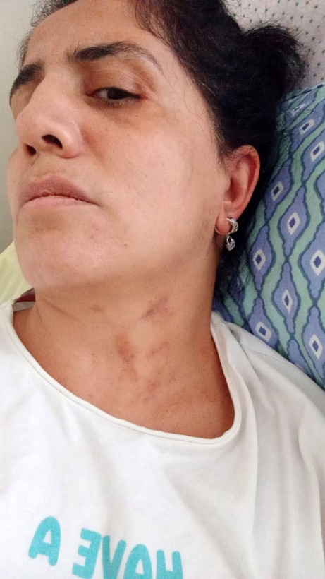 Bebek sahibi olamadığı için eşinden şiddet gördü, ölümle tehdit edildi... "Bunları hak edecek ne yaptım" - Resim: 6