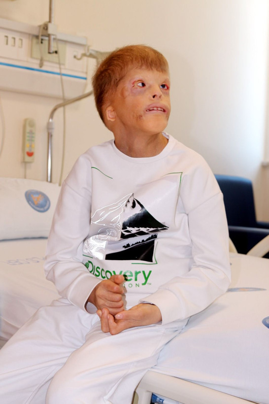 Gözleri kurtarılan Myhailo'ya, şimdi kulak kepçesi yapılacak - Resim: 2