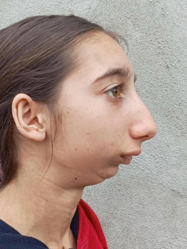 3 yaşında geçirdiği kaza hayatını altüst etti... Gürcü Mariam, şifayı Türkiye’de buldu - Resim: 4