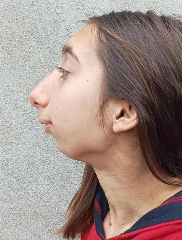 3 yaşında geçirdiği kaza hayatını altüst etti... Gürcü Mariam, şifayı Türkiye’de buldu - Resim: 8