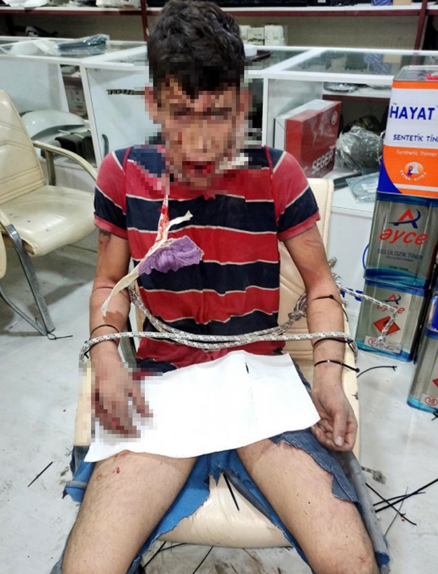 3 gün işkence yaptılar, dişlerini kırıp hamam böceği yedirdiler! 'Madem işkence görmedim, sanıkların telefonunda işkence fotoğraflarının ne işi var?' - Resim: 2