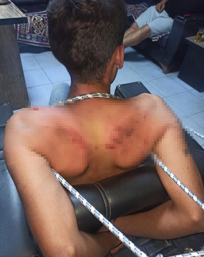 3 gün işkence yaptılar, dişlerini kırıp hamam böceği yedirdiler! 'Madem işkence görmedim, sanıkların telefonunda işkence fotoğraflarının ne işi var?' - Resim: 4