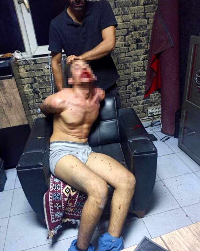 3 gün işkence yaptılar, dişlerini kırıp hamam böceği yedirdiler! 'Madem işkence görmedim, sanıkların telefonunda işkence fotoğraflarının ne işi var?' - Resim: 6