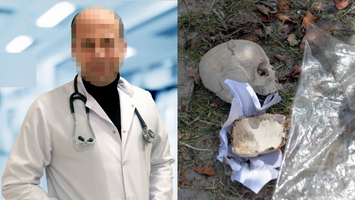 Adana'da çöpte bulunan kafatasının sırrı çözüldü - Resim : 1