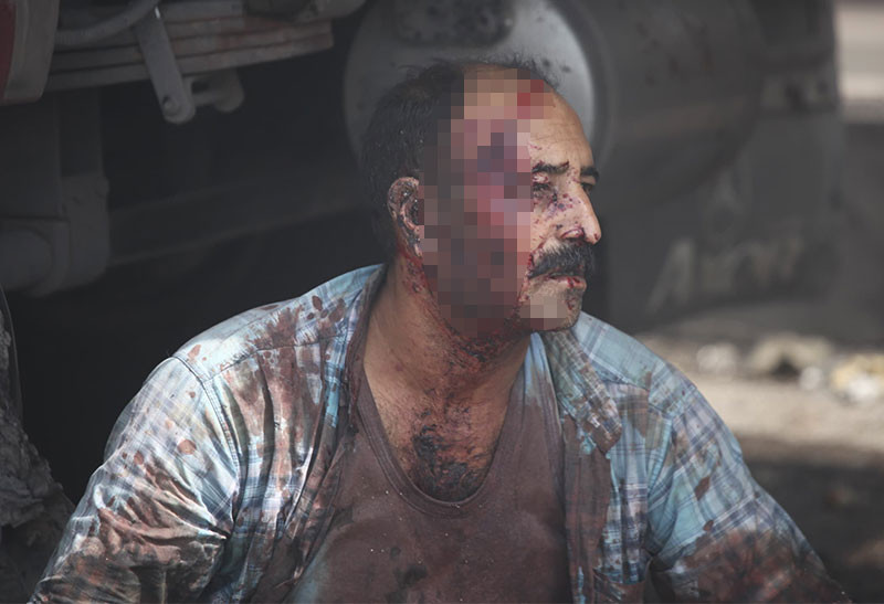 İran'ın Bender Abbas Limanı'ndaki patlamada 14 ölü, 700 yaralı - Resim : 2