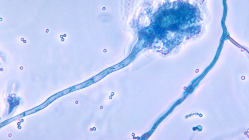 Ölümcül mantar hastalığı, küresel ısınmayla yayılabilir
