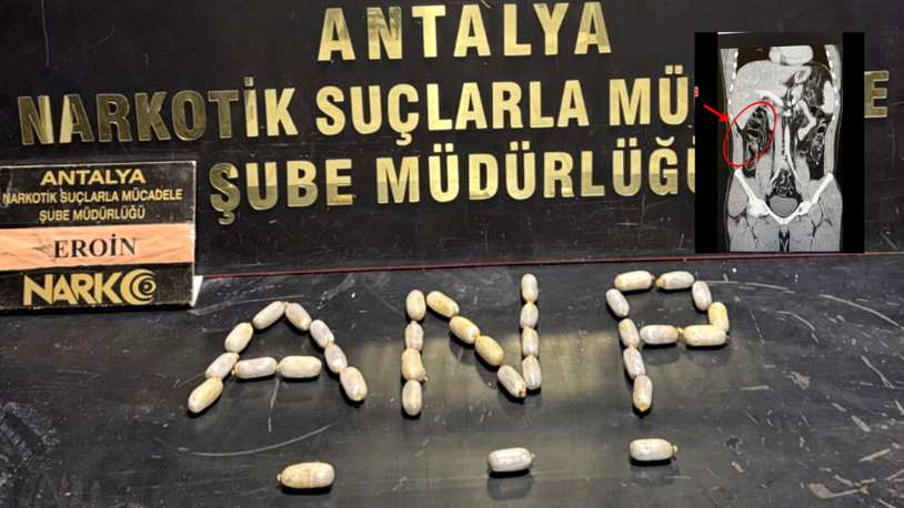 Havalimanında yakalanan 2 şüphelinin, 35 kapsül eroin yuttuğu belirlendi