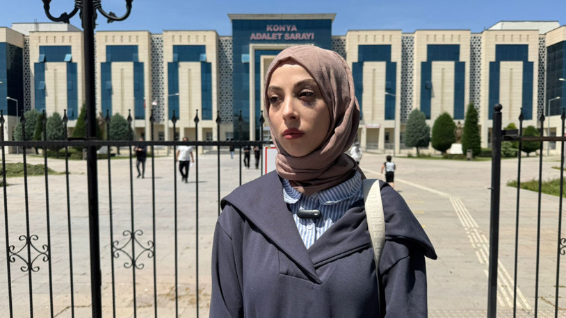 Eski eşi tarafından darbedilen Sena: Kadın cinayeti olarak anılmak istemiyorum