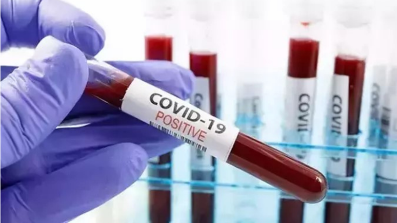 ABD’de her hafta 300’den fazla kişi Covid-19 nedeniyle hayatını kaybediyor