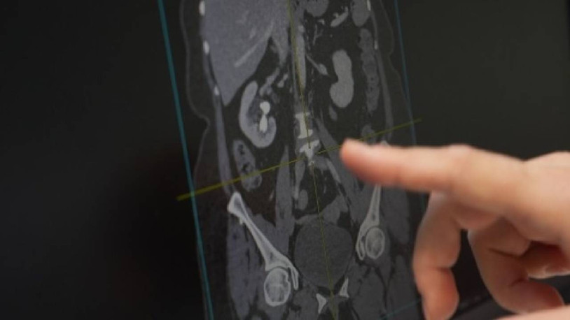 ‘Dengeli bir diyet birçok fizyolojik mekanizmayı doğrudan etkiliyor’