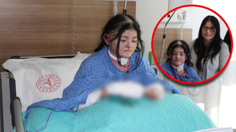 Amerikalı Arias'ın 20 yıldır kullanamadığı parmakları Eskişehir'deki operasyonla açıldı - Resim: 1