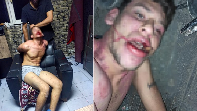3 gün işkence yaptılar, dişlerini kırıp hamam böceği yedirdiler! 'Madem işkence görmedim, sanıkların telefonunda işkence fotoğraflarının ne işi var?' - Resim: 1