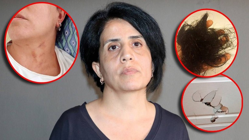 Bebek sahibi olamadığı için eşinden şiddet gördü, ölümle tehdit edildi... "Bunları hak edecek ne yaptım" - Resim: 1