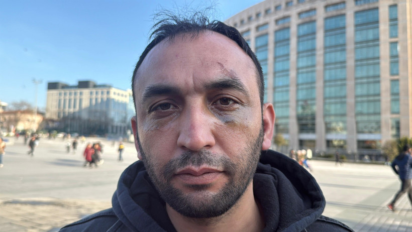 Kağıthane’de sevgilisinin evinde dehşeti yaşadı! Tuzağa düşürülüp önce darp sonra gasbedildi - Resim : 1