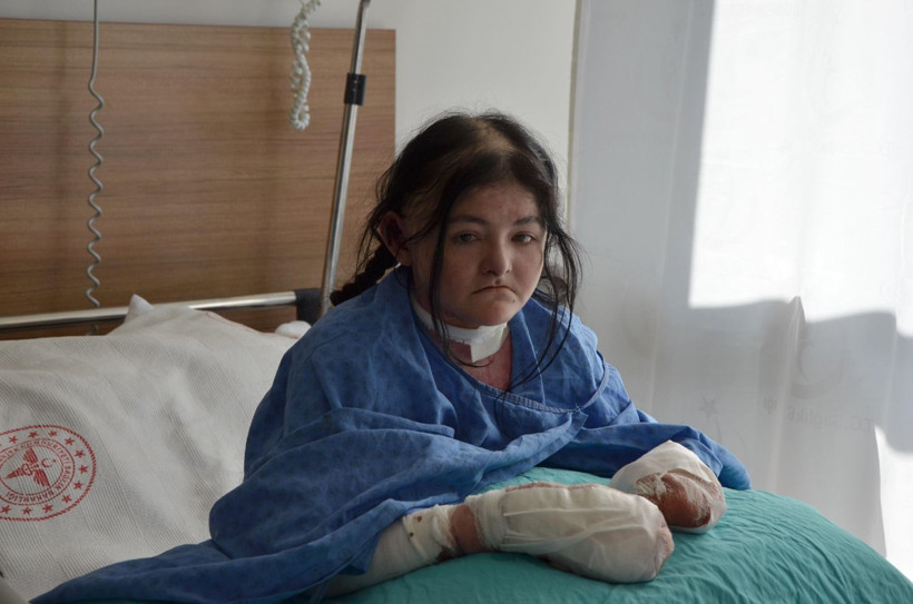 Amerikalı Arias'ın 20 yıldır kullanamadığı parmakları Eskişehir'deki operasyonla açıldı - Resim: 2