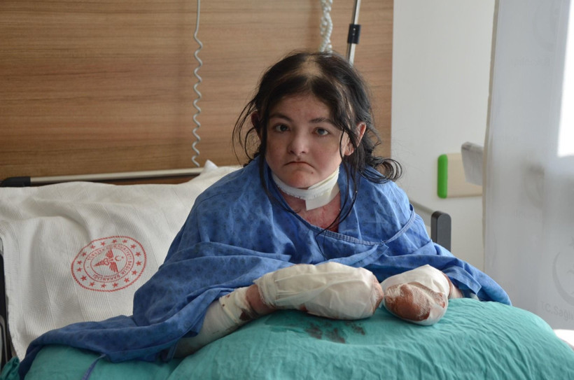 Amerikalı Arias'ın 20 yıldır kullanamadığı parmakları Eskişehir'deki operasyonla açıldı - Resim: 3