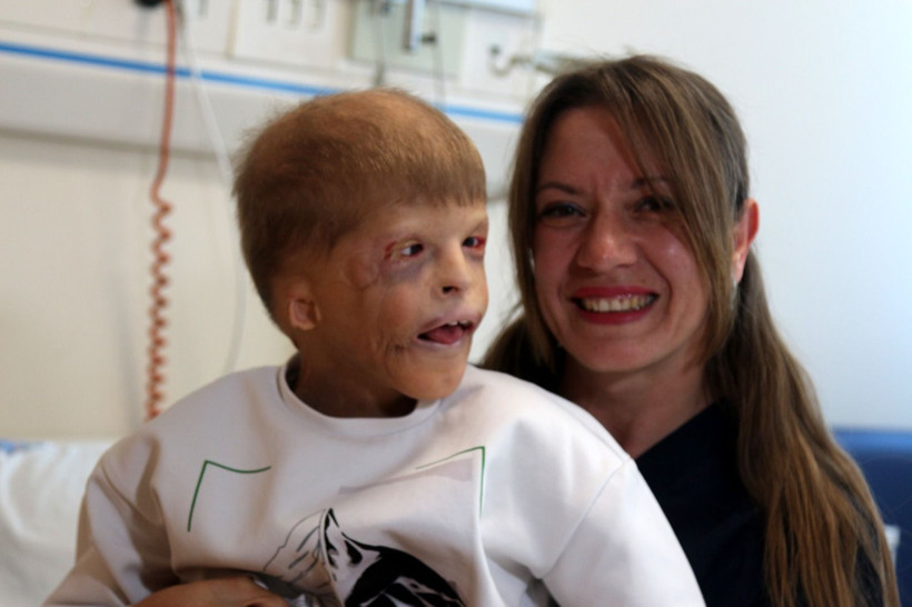 Gözleri kurtarılan Myhailo'ya, şimdi kulak kepçesi yapılacak - Resim: 6