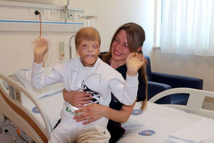 Gözleri kurtarılan Myhailo'ya, şimdi kulak kepçesi yapılacak - Resim: 1