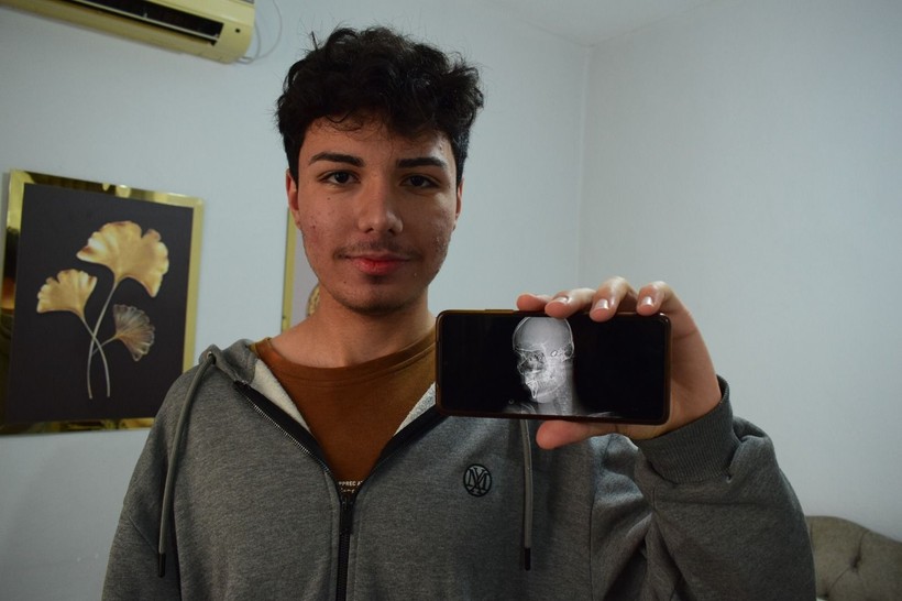 1,5 yıl önce başına isabet eden yorgun mermi hâlâ çıkarılamadı... Her gün ölüm korkusu yaşıyor - Resim: 9