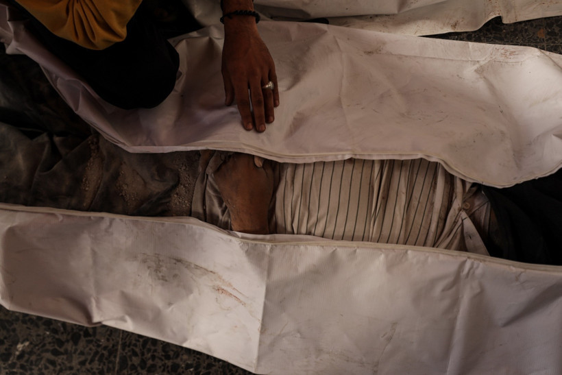 İsrail, Gazze'de Filistinlilerin sığındığı okula saldırdı: Minik Verd, alevlerin arasından mucize eseri kurtuldu - Resim : 8