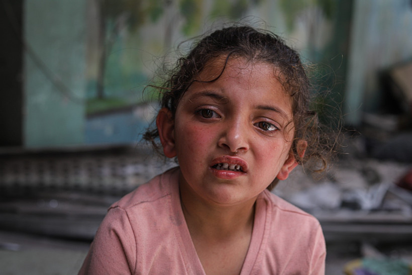 İsrail, Gazze'de Filistinlilerin sığındığı okula saldırdı: Minik Verd, alevlerin arasından mucize eseri kurtuldu - Resim : 5